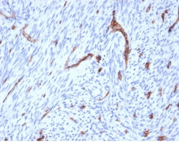 CD31/PECAM-1 (Endothelial Cell Marker) Antibody in Immunohistochemistry (Paraffin) (IHC (P))