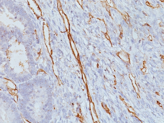 CD31/PECAM-1 (Endothelial Cell Marker) Antibody in Immunohistochemistry (Paraffin) (IHC (P))