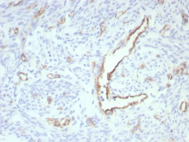 CD31/PECAM-1 (Endothelial Cell Marker) Antibody in Immunohistochemistry (Paraffin) (IHC (P))
