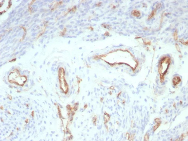 CD31/PECAM-1 (Endothelial Cell Marker) Antibody in Immunohistochemistry (Paraffin) (IHC (P))
