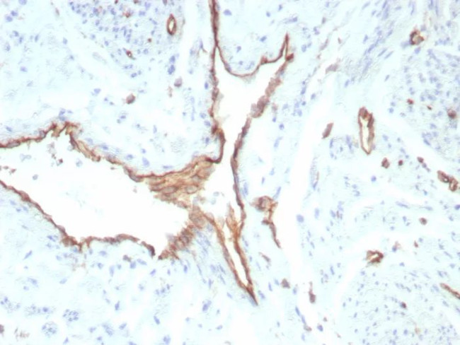 CD31/PECAM-1 (Endothelial Cell Marker) Antibody in Immunohistochemistry (Paraffin) (IHC (P))