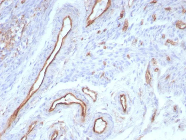CD31/PECAM-1 (Endothelial Cell Marker) Antibody in Immunohistochemistry (Paraffin) (IHC (P))