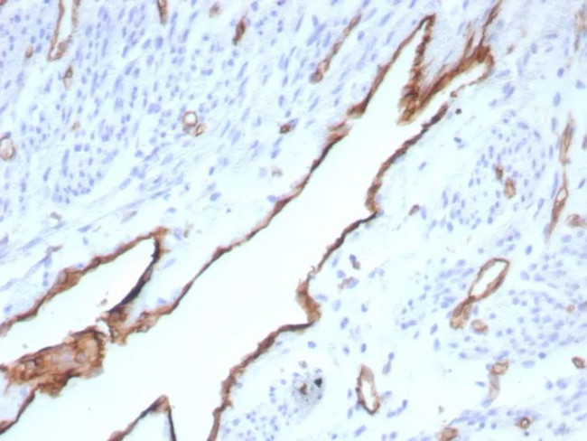 CD31/PECAM-1 (Endothelial Cell Marker) Antibody in Immunohistochemistry (Paraffin) (IHC (P))