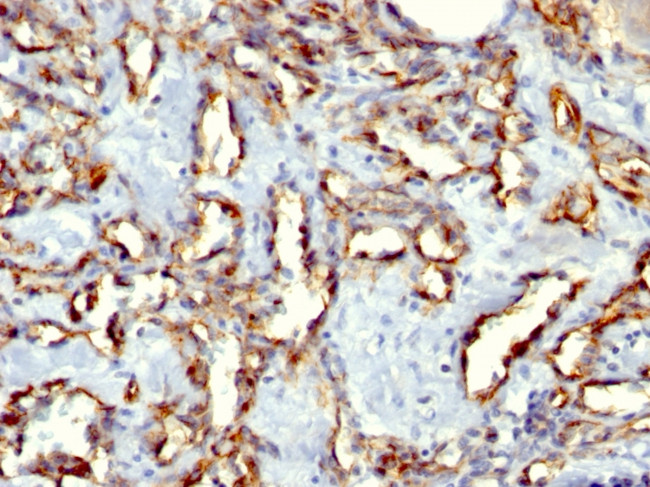 Cd31 CD31/PECAM-1 (Endothelial Cell Marker) Monoclonal Antibody (C31.3, C31 ...