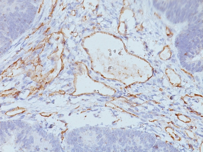 CD31/PECAM-1 (Endothelial Cell Marker) Antibody in Immunohistochemistry (Paraffin) (IHC (P))