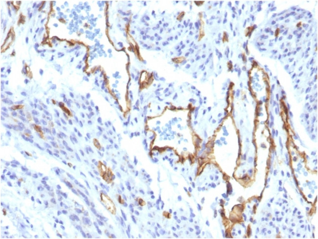 CD31/PECAM-1 (Endothelial Cell Marker) Antibody in Immunohistochemistry (Paraffin) (IHC (P))