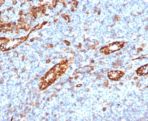 CD31/PECAM-1 (Endothelial Cell Marker) Antibody in Immunohistochemistry (Paraffin) (IHC (P))