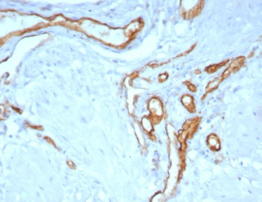 CD31/PECAM-1 (Endothelial Cell Marker) Antibody in Immunohistochemistry (Paraffin) (IHC (P))