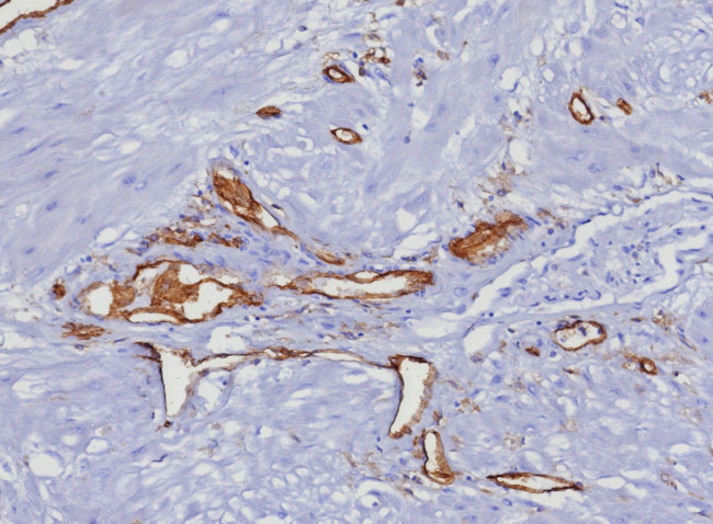 CD31/PECAM-1 (Endothelial Cell Marker) Antibody in Immunohistochemistry (Paraffin) (IHC (P))