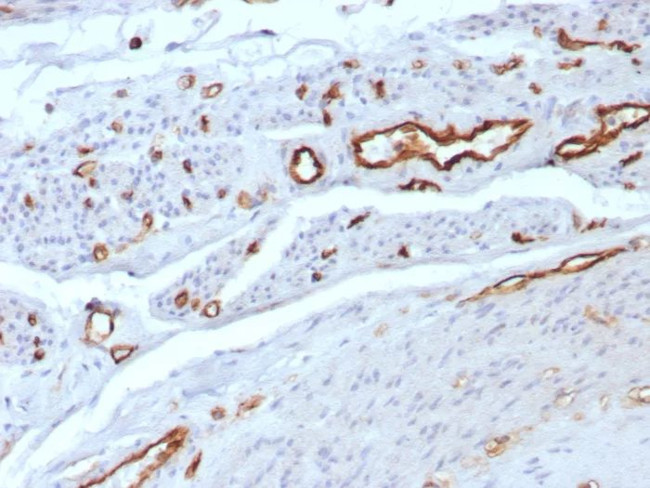 CD31/PECAM-1 (Endothelial Cell Marker) Antibody in Immunohistochemistry (Paraffin) (IHC (P))
