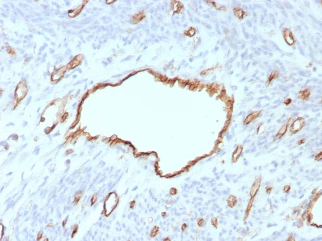 CD31/PECAM-1 (Endothelial Cell Marker) Antibody in Immunohistochemistry (Paraffin) (IHC (P))