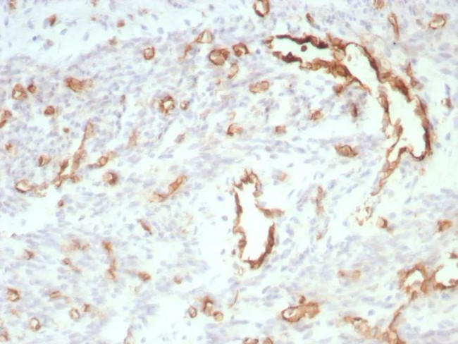 CD31/PECAM-1 (Endothelial Cell Marker) Antibody in Immunohistochemistry (Paraffin) (IHC (P))