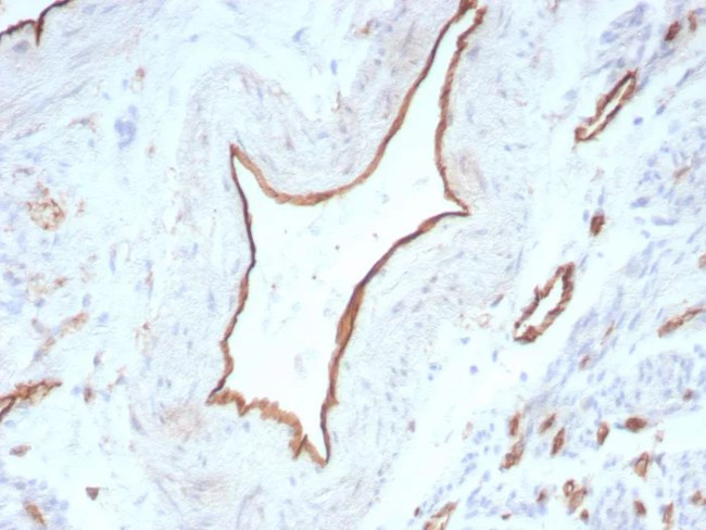 CD31/PECAM-1 (Endothelial Cell Marker) Antibody in Immunohistochemistry (Paraffin) (IHC (P))