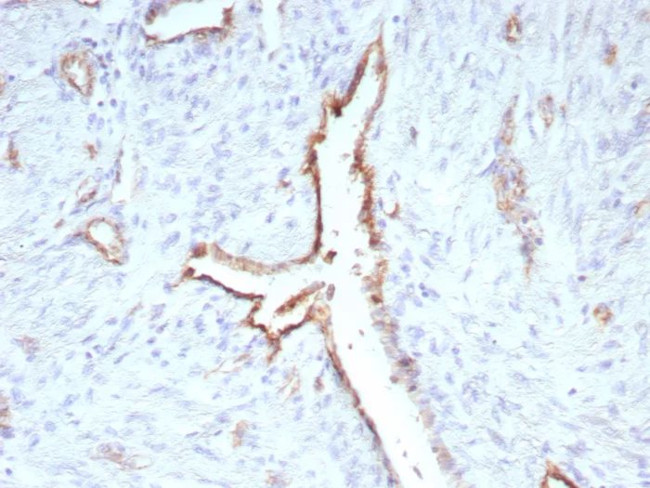 CD31/PECAM-1 (Endothelial Cell Marker) Antibody in Immunohistochemistry (Paraffin) (IHC (P))