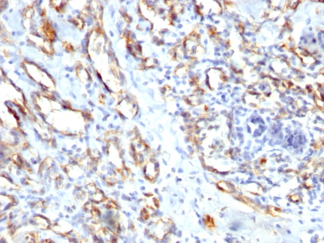 CD31/PECAM-1 (Endothelial Cell Marker) Antibody in Immunohistochemistry (Paraffin) (IHC (P))