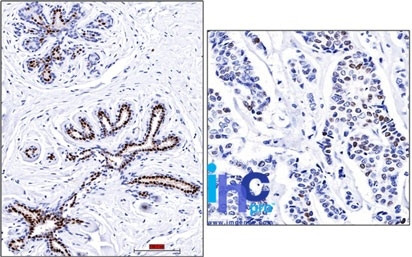 Progesterone Receptor (Marker of Progestin Dependence) Antibody in Immunohistochemistry (Paraffin) (IHC (P))