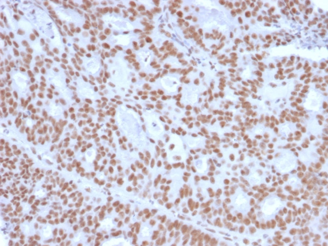 Progesterone Receptor (Marker of Progestin Dependence) Antibody in Immunohistochemistry (Paraffin) (IHC (P))