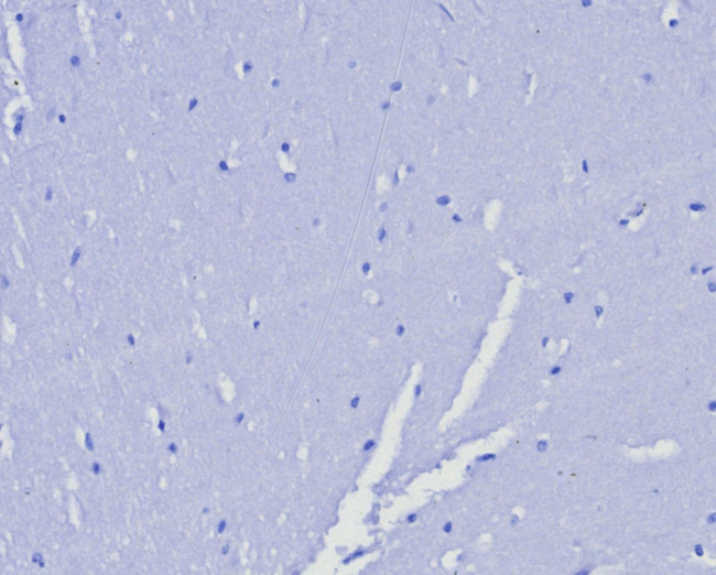 Progesterone Receptor (Marker of Progestin Dependence) Antibody in Immunohistochemistry (Paraffin) (IHC (P))