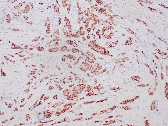 Progesterone Receptor (Marker of Progestin Dependence) Antibody in Immunohistochemistry (Paraffin) (IHC (P))