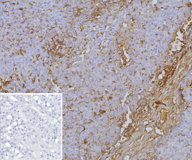 p170/MDR1/CD243 Antibody in Immunohistochemistry (Paraffin) (IHC (P))