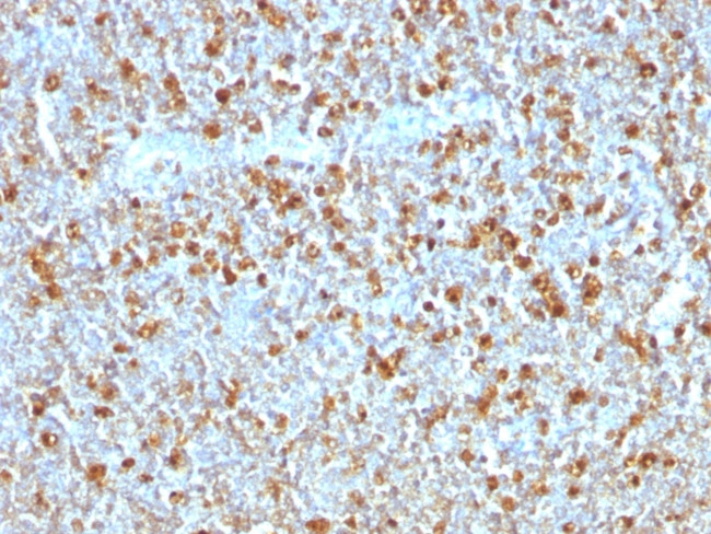 Alpha-1-Antitrypsin (SERPINA1) Antibody in Immunohistochemistry (Paraffin) (IHC (P))