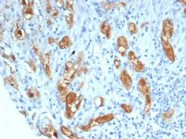 SERPINB5/Maspin Antibody in Immunohistochemistry (Paraffin) (IHC (P))