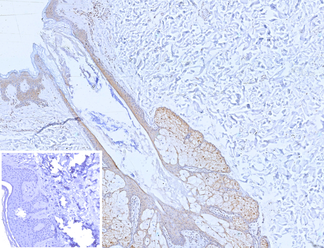 SERPINB5/Maspin (Tumor Suppressor & Epithelial Biomarker) Antibody in Immunohistochemistry (Paraffin) (IHC (P))