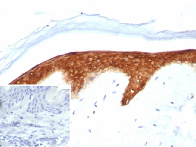 SERPINB5/Maspin Antibody in Immunohistochemistry (Paraffin) (IHC (P))
