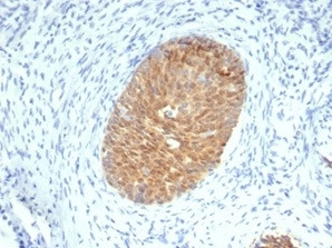 SERPINB5/Maspin Antibody in Immunohistochemistry (Paraffin) (IHC (P))