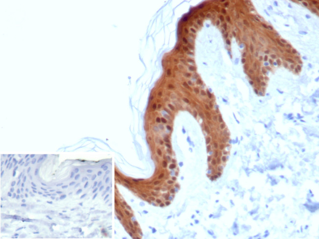 SERPINB5/Maspin Antibody in Immunohistochemistry (Paraffin) (IHC (P))