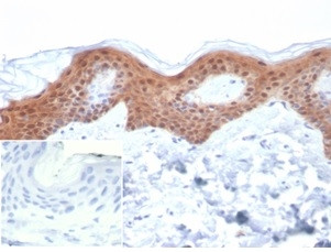 SERPINB5/Maspin Antibody in Immunohistochemistry (Paraffin) (IHC (P))