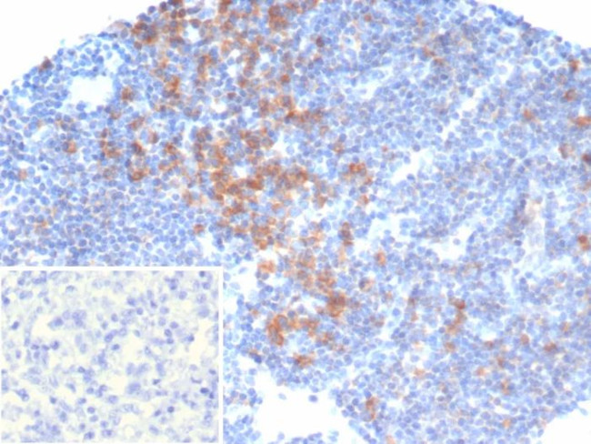 PIK3CD Antibody in Immunohistochemistry (Paraffin) (IHC (P))