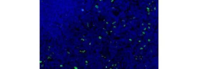 AIRE Antibody in Immunohistochemistry (Frozen) (IHC (F))