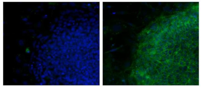 NLGN4X (Neuroligin-4) Antibody in Immunocytochemistry (ICC/IF)