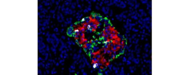 Glucagon Antibody in Immunohistochemistry (Paraffin) (IHC (P))