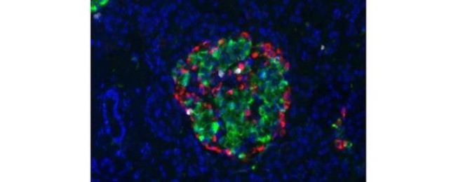 Insulin Antibody in Immunohistochemistry (Paraffin) (IHC (P))