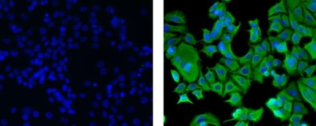 Cytokeratin 18 Antibody in Immunocytochemistry (ICC/IF)
