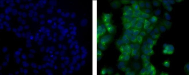 CD227 (Mucin 1) Antibody in Immunocytochemistry (ICC/IF)