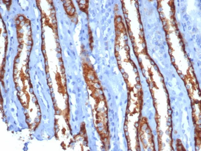 IL20RA (Interleukin 20 Receptor Subunit Alpha) Antibody in Immunohistochemistry (Paraffin) (IHC (P))