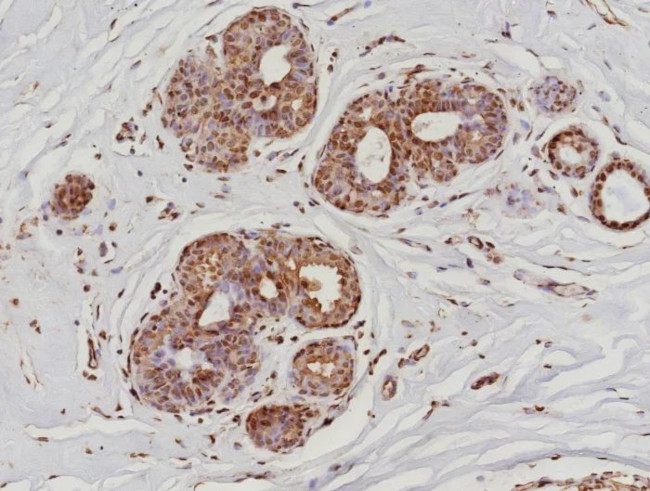 Phospho-RNA pol II CTD (Ser5) Antibody in Immunohistochemistry (Paraffin) (IHC (P))