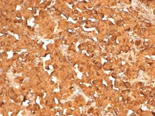 ACTH (Adrenocorticotrophic Hormone) (Pituitary Marker) Antibody in Immunohistochemistry (Paraffin) (IHC (P))