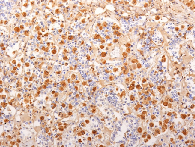ACTH (Adrenocorticotrophic Hormone) (Pituitary Marker) Antibody in Immunohistochemistry (Paraffin) (IHC (P))