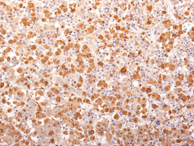 ACTH (Adrenocorticotrophic Hormone) (Pituitary Marker) Antibody in Immunohistochemistry (Paraffin) (IHC (P))