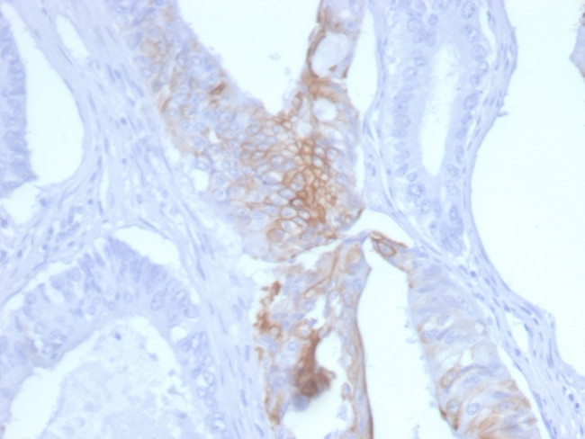 Cytokeratin 20 (KRT20) (Colorectal Epithelial Marker) Antibody in Immunohistochemistry (Paraffin) (IHC (P))
