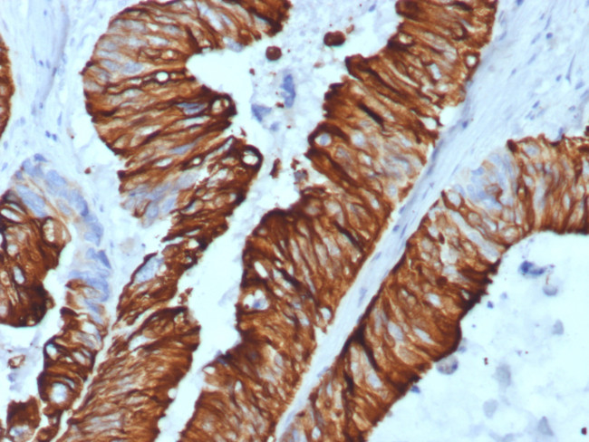 Cytokeratin 20 (KRT20) (Colorectal Epithelial Marker) Antibody in Immunohistochemistry (Paraffin) (IHC (P))