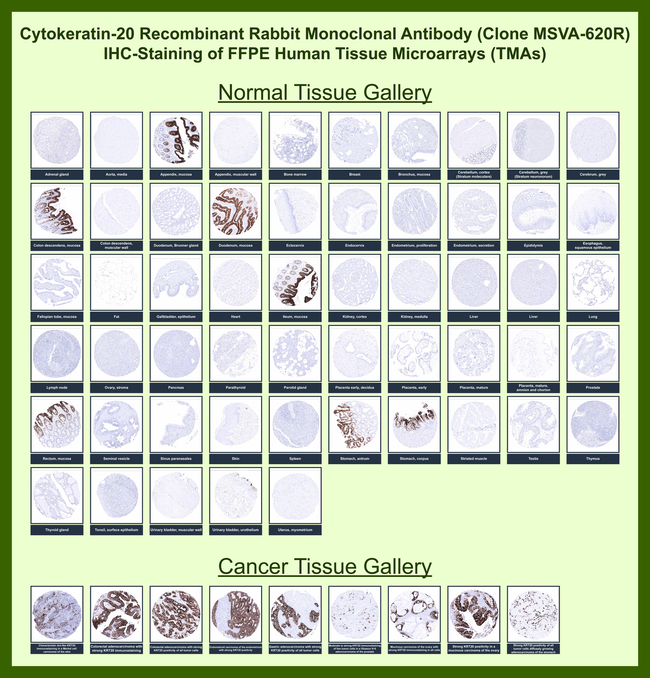 Cytokeratin 20 (KRT20) (Colorectal Epithelial Marker) Antibody in Immunohistochemistry (Paraffin) (IHC (P))