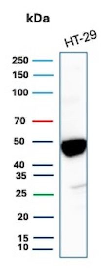 Cytokeratin 20 (KRT20) (Colorectal Epithelial Marker) Antibody in Western Blot (WB)