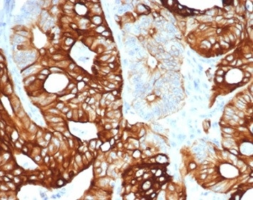 Cytokeratin 20 (KRT20) (Colorectal Epithelial Marker) Antibody in Immunohistochemistry (Paraffin) (IHC (P))