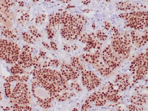 POU1F1/PIT-1 Antibody in Immunohistochemistry (Paraffin) (IHC (P))