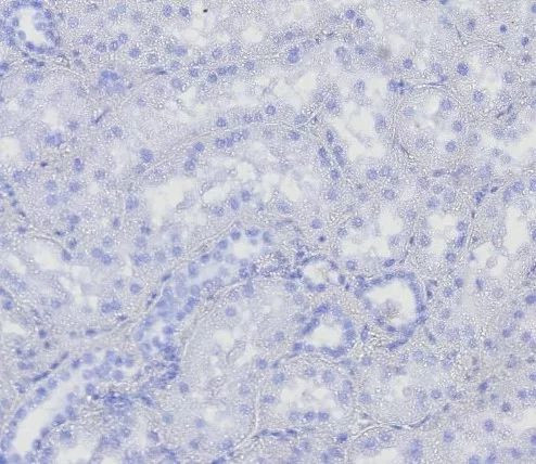 BOB.1 (B-Cell Marker) Antibody in Immunohistochemistry (Paraffin) (IHC (P))